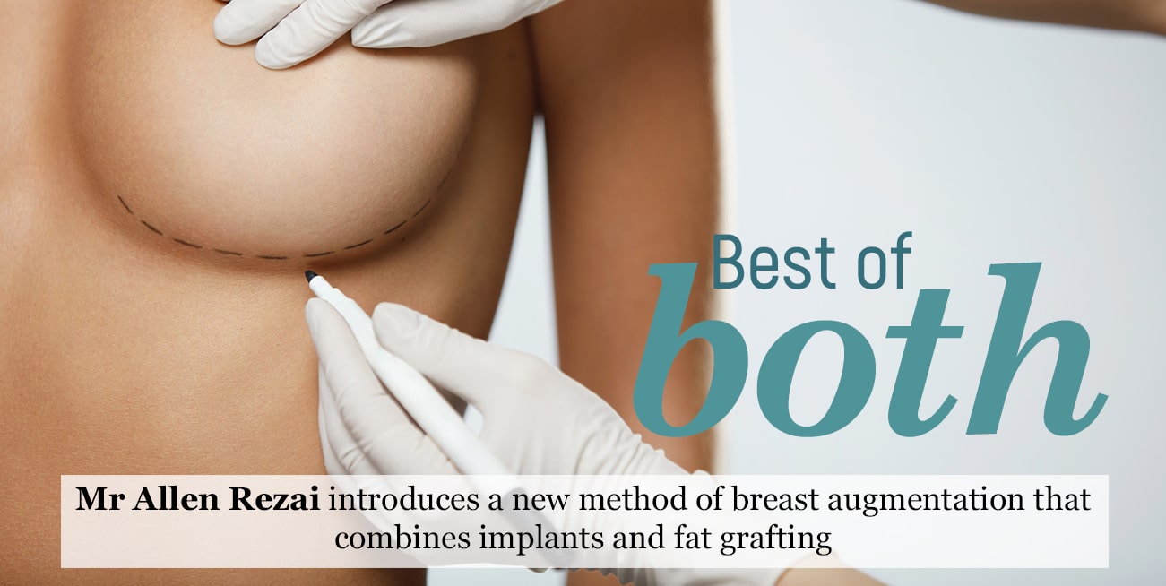 Mr Allen Rezai introduces a new method of breast augmentation that combines implants and fat grafting